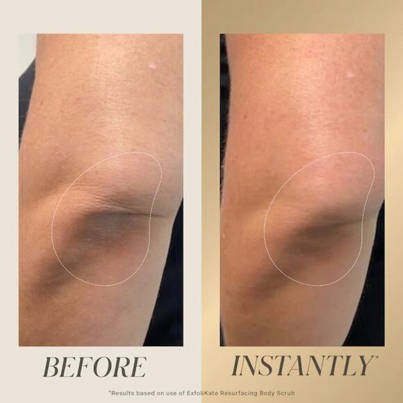 Kate Somerville ExfoliKate Resurfacing Body Scrub - Picture 3 of 8